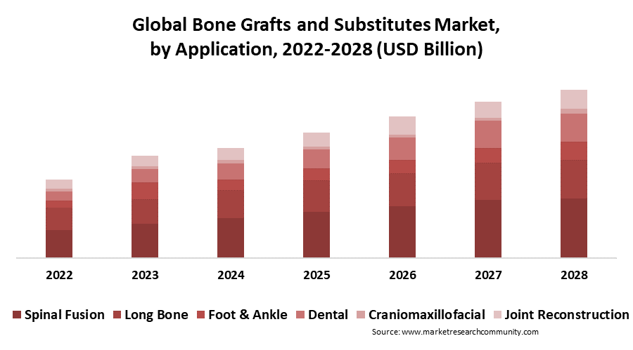 bone grafts and substitutes market by application