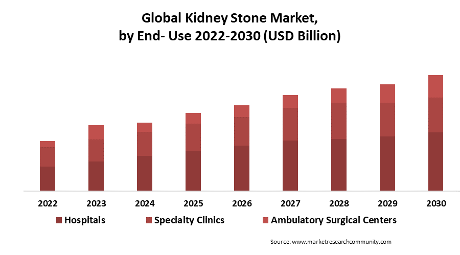 kidney stone management market by end use