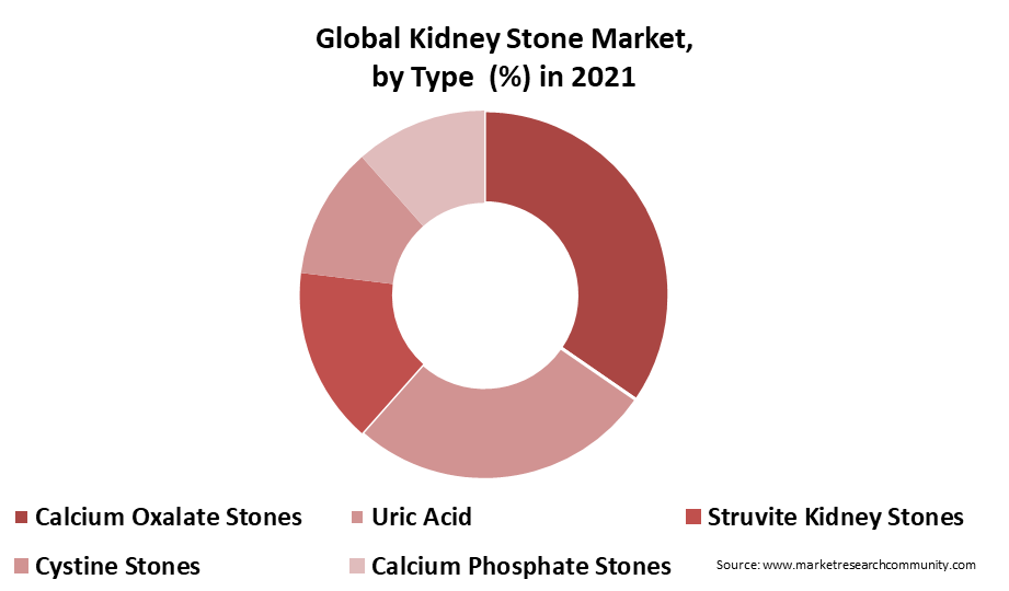 kidney stone management market by type